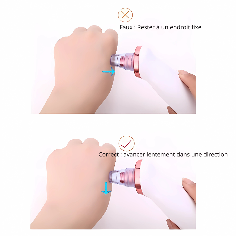 ClearSuction
